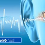 Electrocochleography (ECochG) Testing: Your Guide to Better Hearing Health