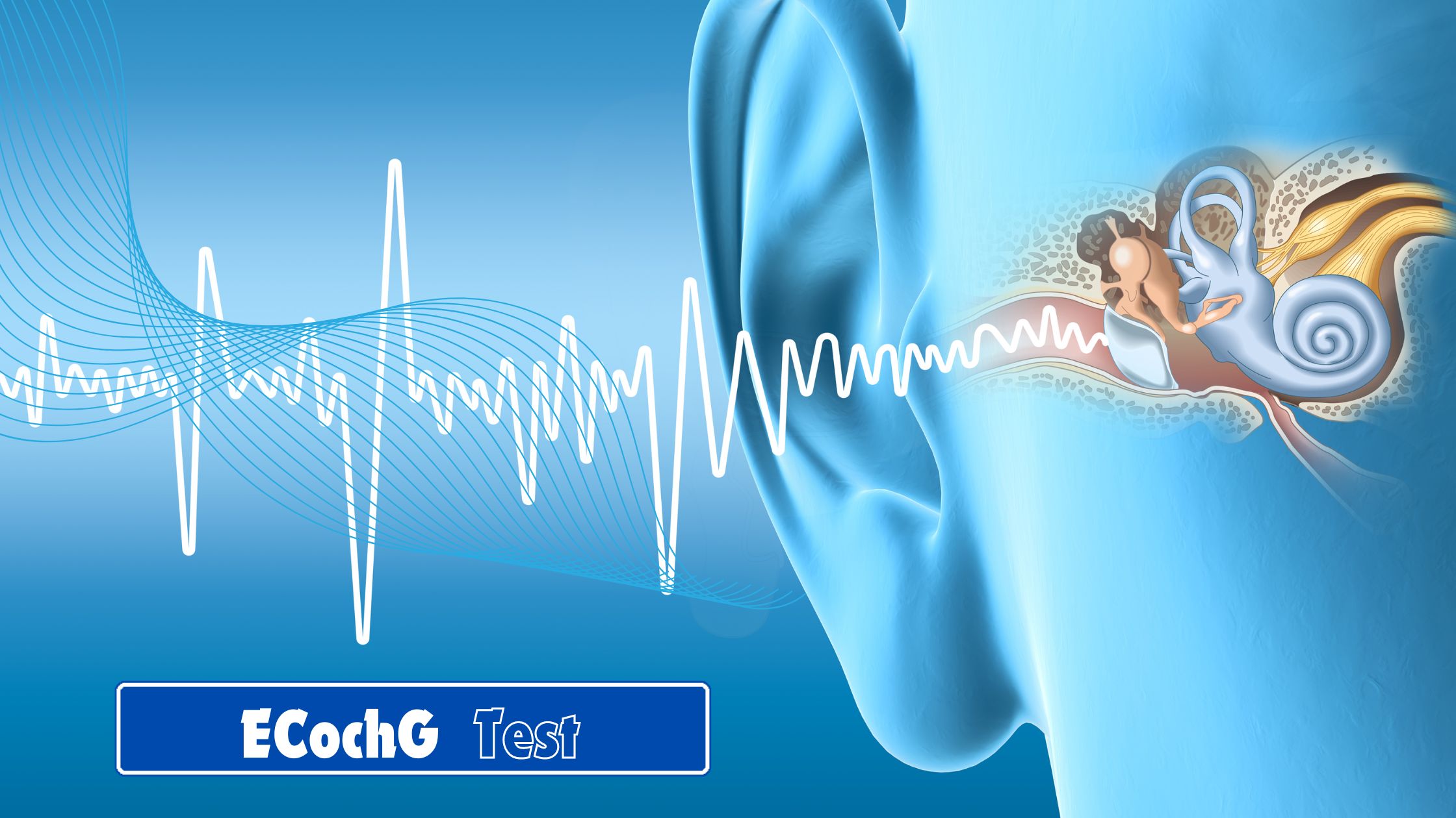 Electrocochleography (ECochG): Your Key to Hearing Health